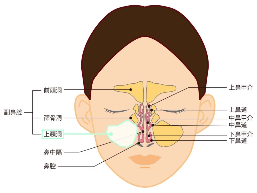 もちづき歯科医院 GBR術