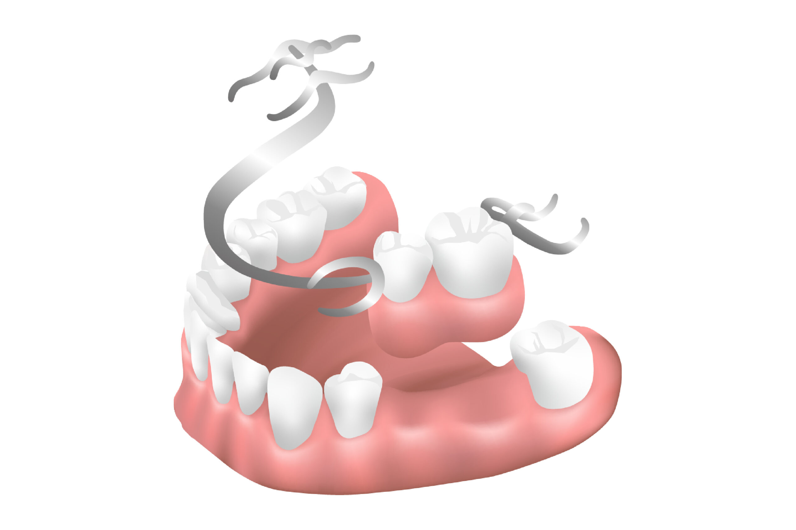もちづき歯科医院 部分入れ歯